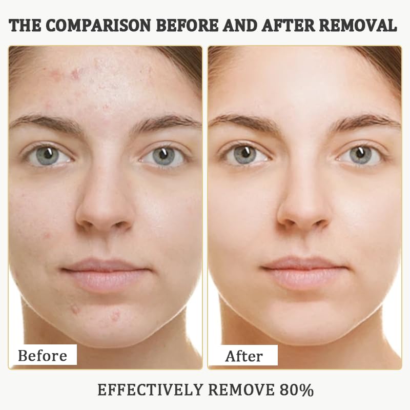XQMVCO soothing allantoin formula supports calm skin