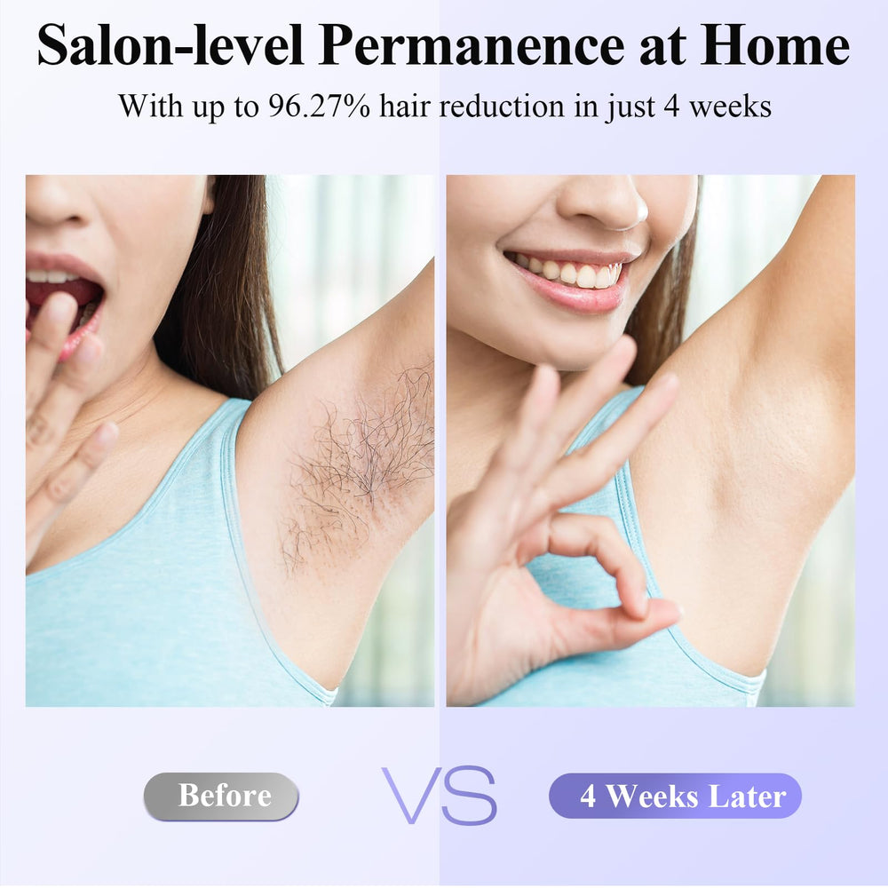 Xsoul Laser Hair Removal large 330mm2 window speeds full-area sessions.