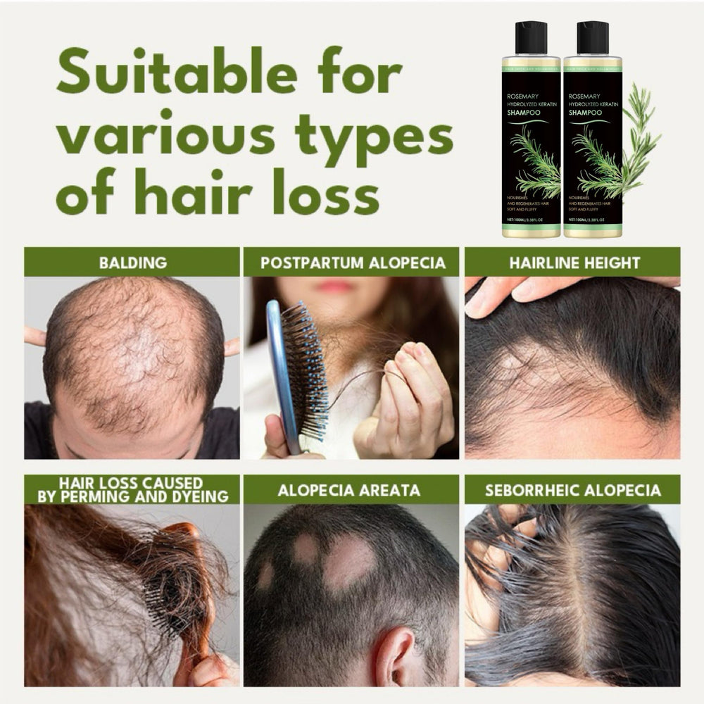 Scalp massage cue image from XYFSZDQJZHG shampoo demonstrating improved circulation