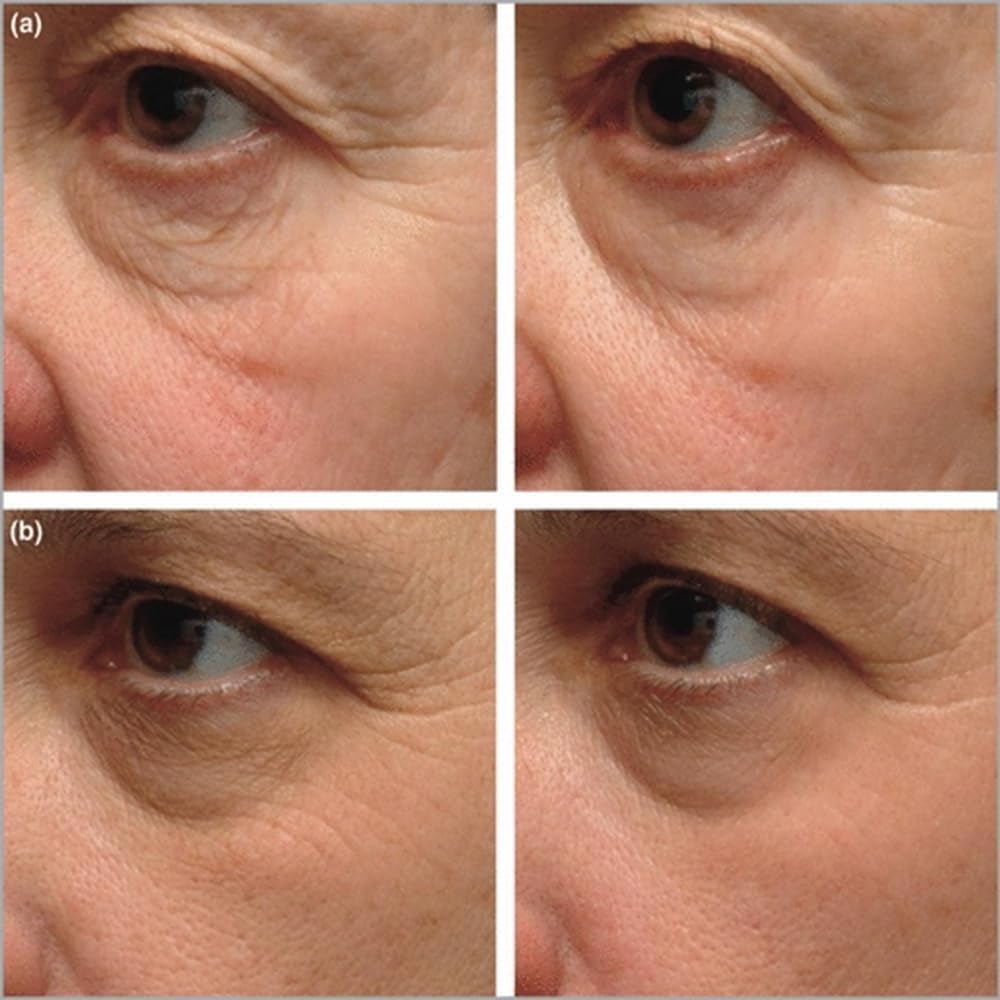XYJIAXI Instant Firming Eye Serum application on eye area showing smooth, radiant skin.