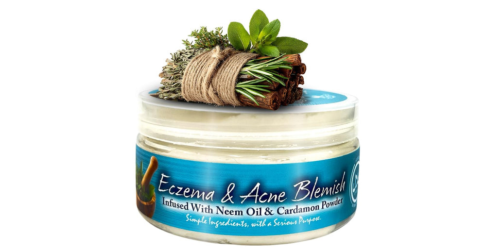 Yadain Whipped Shea Butter jar for eczema-prone and acne-prone skin hydration