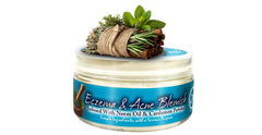 Yadain Whipped Shea Butter jar for eczema-prone and acne-prone skin hydration