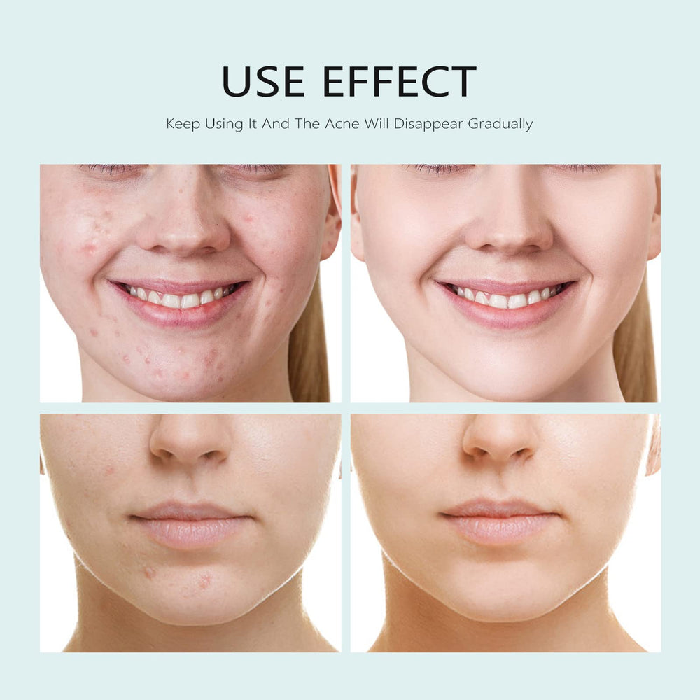 YAFUSIPE sheet mask hydrating provides deep moisture for dry skin.