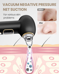 YAGETU Pore Vacuum with five probes for customized cleansing.