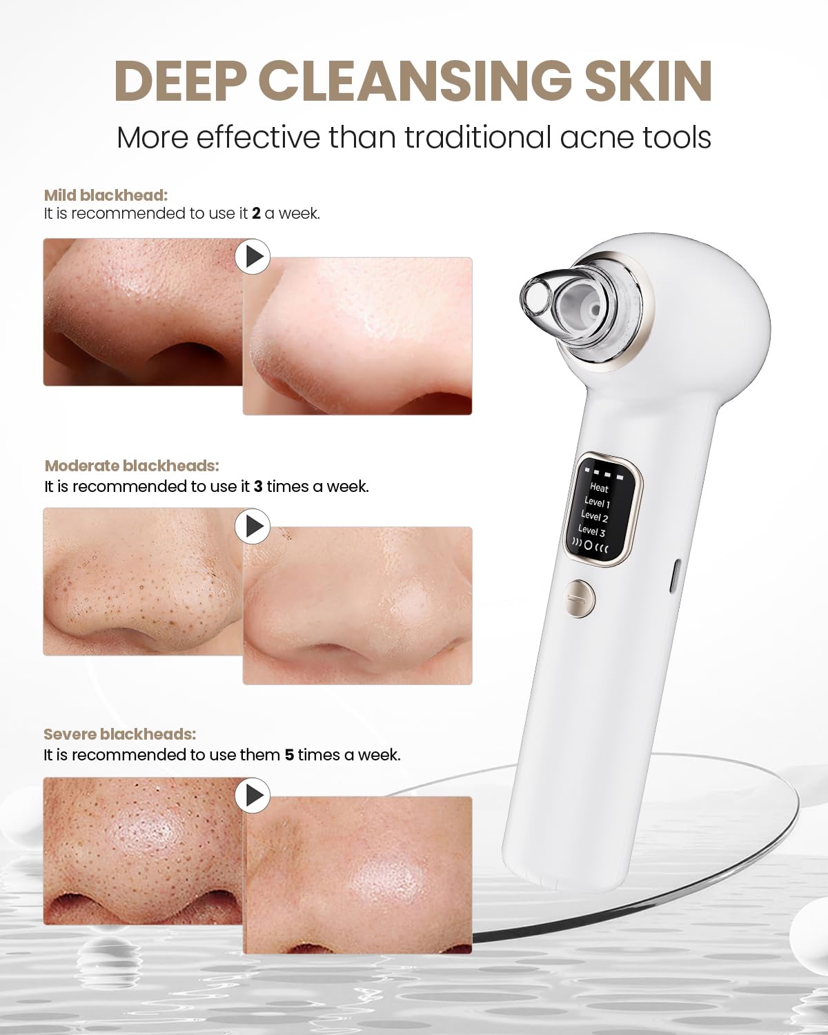 YAGETU Pore Vacuum Remover attachments set for versatile routines
