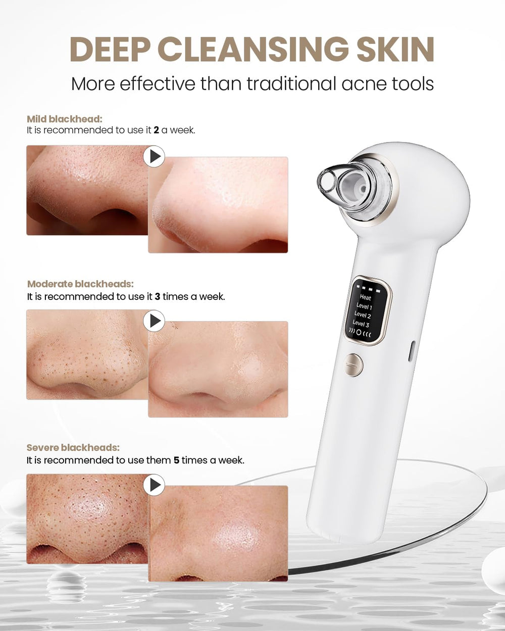 YAGETU Pore Vacuum Remover attachments set for versatile routines