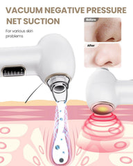 YAGETU Pore Vacuum Remover LCD display indicates power and level