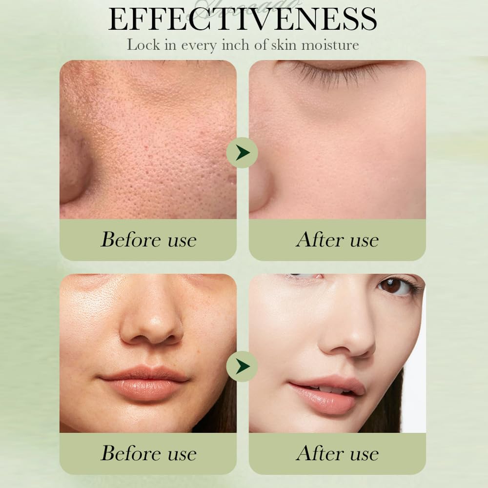 Yasovigi Avocado Face Mask 5pcs for weekly rejuvenation and deep hydration