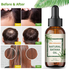 YBW Batana Oil applied to dry scalp hydrates skin.