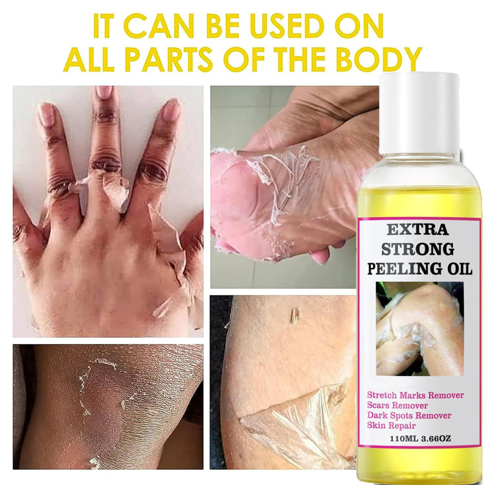 Yellow Peeling Oil after use reveals refined skin texture.