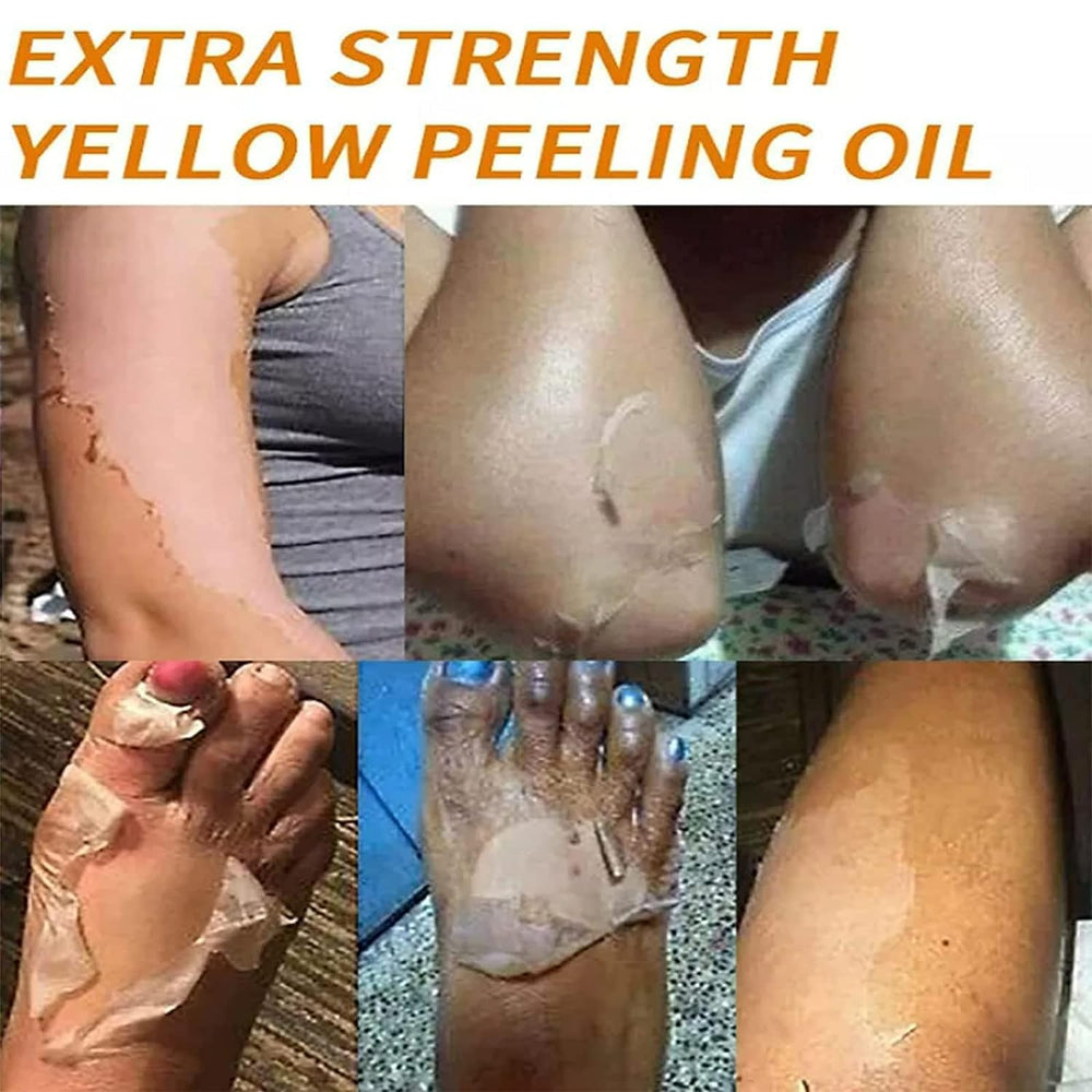 Yellow Peeling Oil packaging on display with size label.