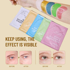 Yeokoe eye patches vitamin-e-aloe-vera close-up, nourishing sensitive skin