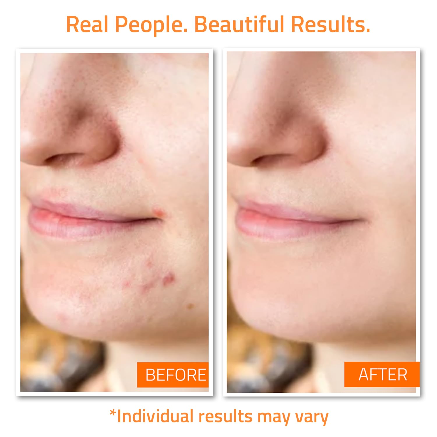 YEOUTH Alcohol-free Toner bottle balancing skin for better serum absorption.