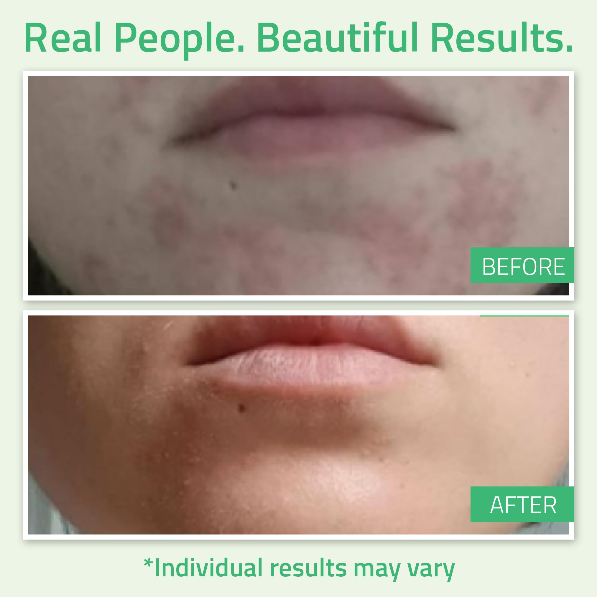 Application scene showing 8-minute leave-on period for refreshed skin