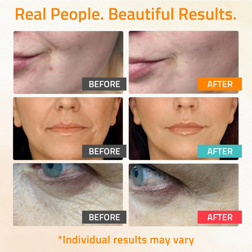 YEOUTH hyaluronic acid serum bottle close-up for hydration and plump look