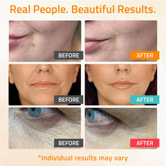 YEOUTH hyaluronic acid serum bottle close-up for hydration and plump look