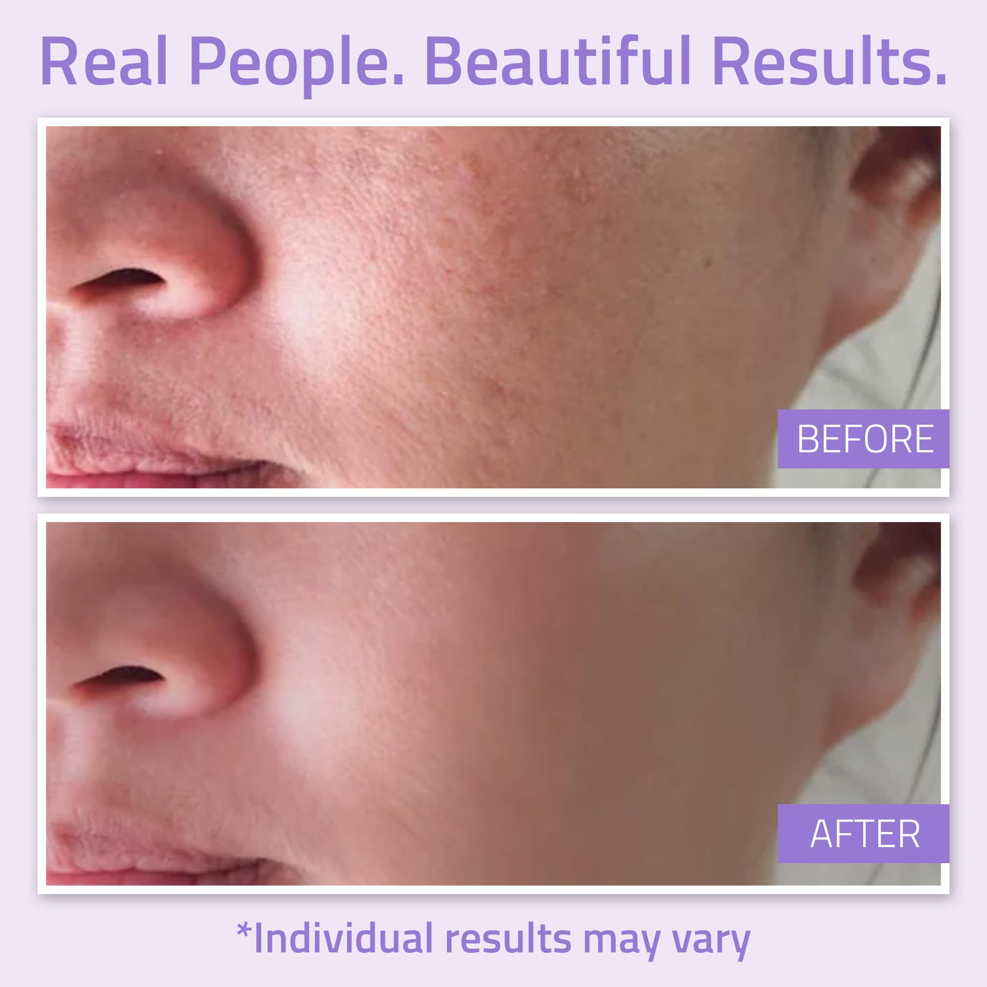 YEOUTH hydrating toner applied before serums to prep the skin.