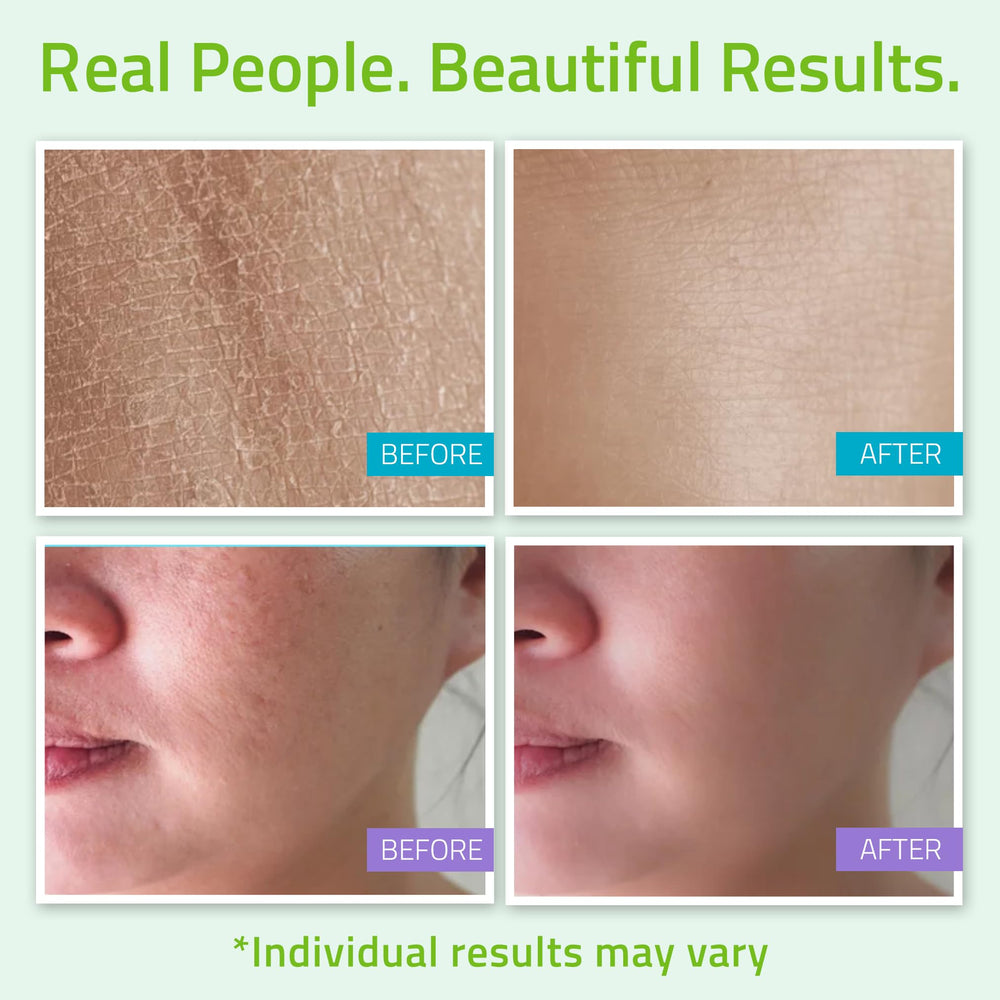 YEOUTH teen skincare kit packaging showing a complete routine.