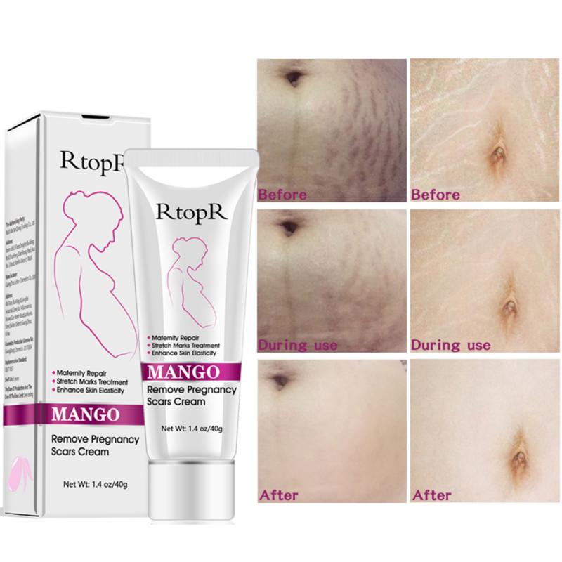 YG LianKai Mango Cream before-after concept; potential improvement in skin texture.