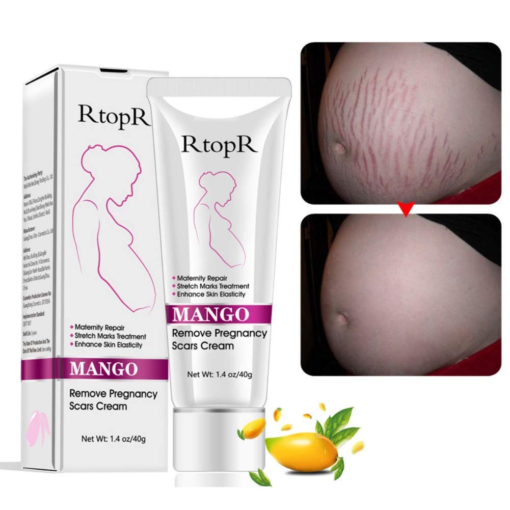YG LianKai Mango Stretch Marks Cream bottle; hydrates and nourishes dry skin.