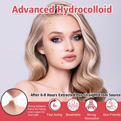 YHOVID 12mm patch close-up for larger spots and quicker coverage.