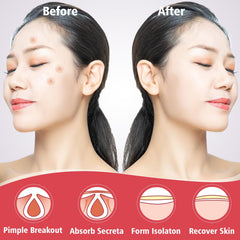 YHOVID 8mm patch close-up for targeted blemish coverage.