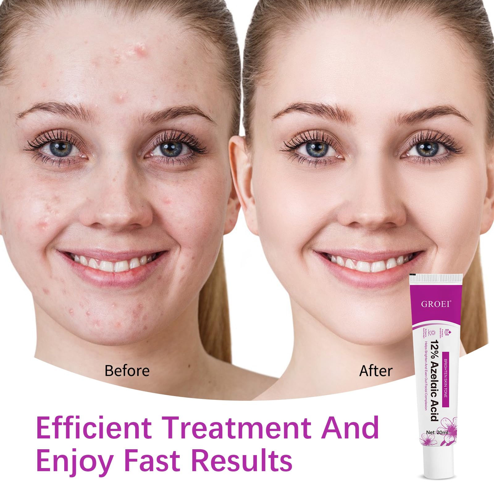 YILEST serum bottle with pump for easy, controlled application.