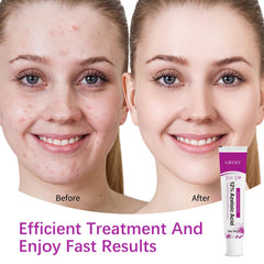 YILEST serum bottle with pump for easy, controlled application.