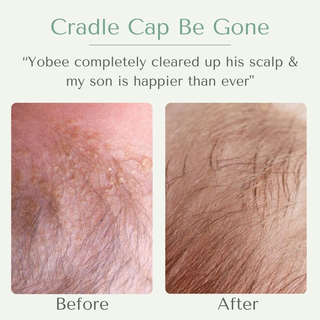 Yobee Ultra Gentle Scalp Mask texture close-up for easy application