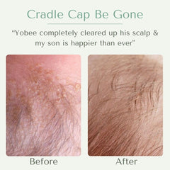 Yobee Ultra Gentle Scalp Mask texture close-up for easy application