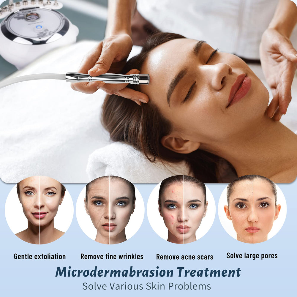Yofuly 68 cmHg suction power for effective pore cleansing