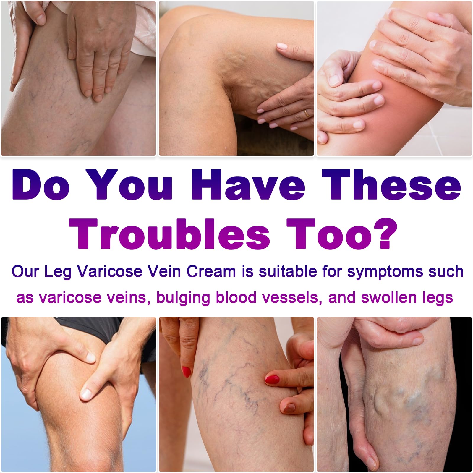 Yongsenina Varicose Veins Cream packaging on display for easy leg care.
