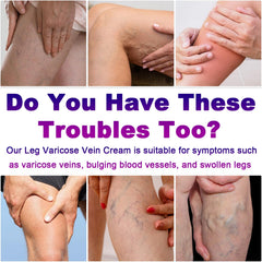 Yongsenina Varicose Veins Cream packaging on display for easy leg care.