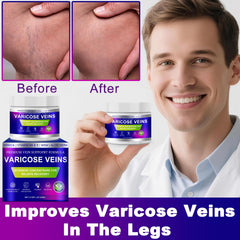Yongsenina Varicose Veins Cream texture swirl indicating quick absorption.