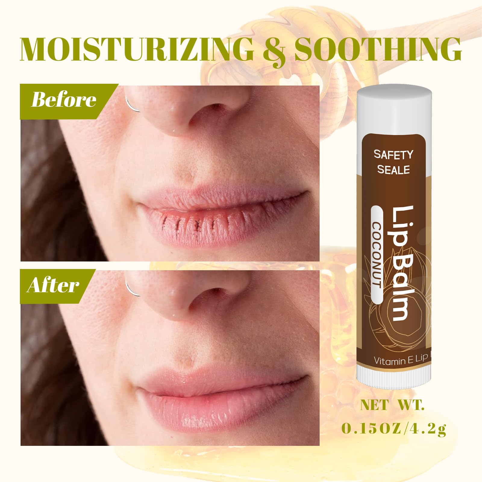 Yopela peach lip balm provides quick hydration and comfort