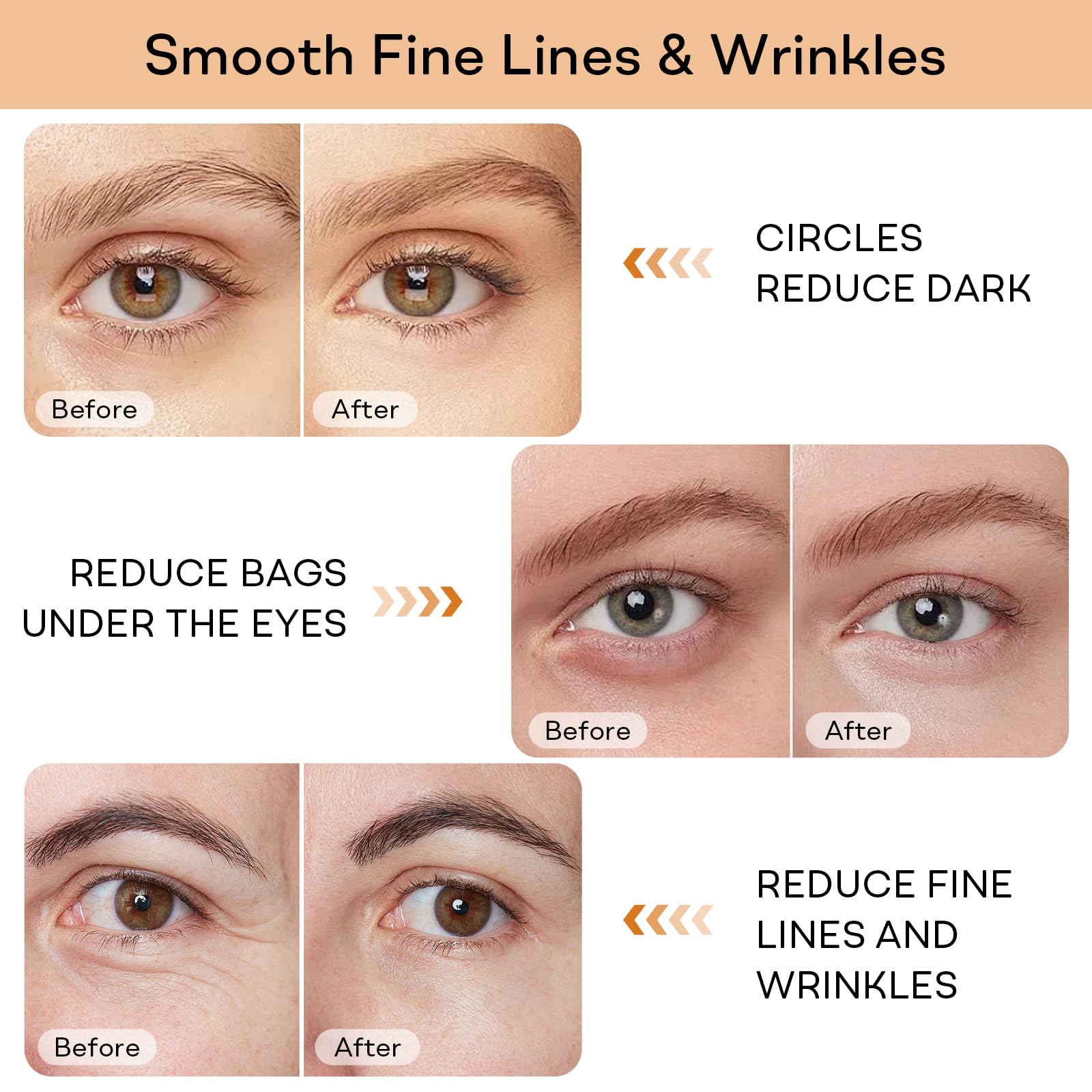 YoPoll Instant Eye Lift Cream under-eye area close-up reveals a firming effect.