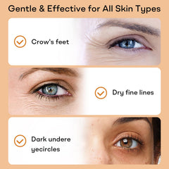 YoPoll Instant Eye Lift Cream jar showcases vitamin E for nourishing care.