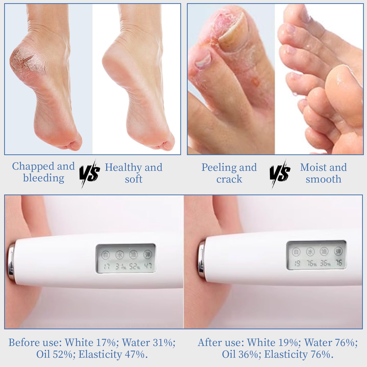 YoungYoungLove non-greasy finish on feet ideal for daily use.