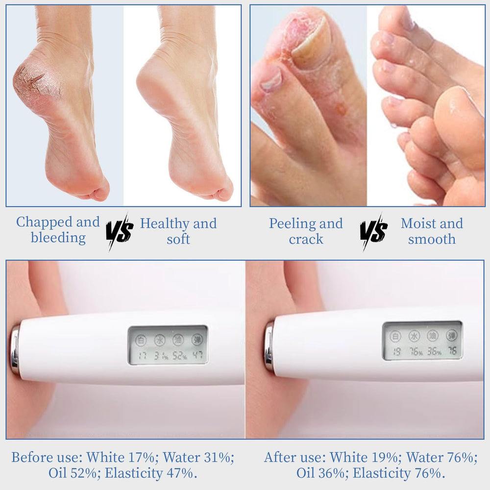 YoungYoungLove non-greasy finish on feet ideal for daily use.
