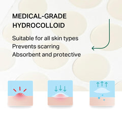 Y'OUR 56-count box with small, medium, and large patches for flexible coverage.