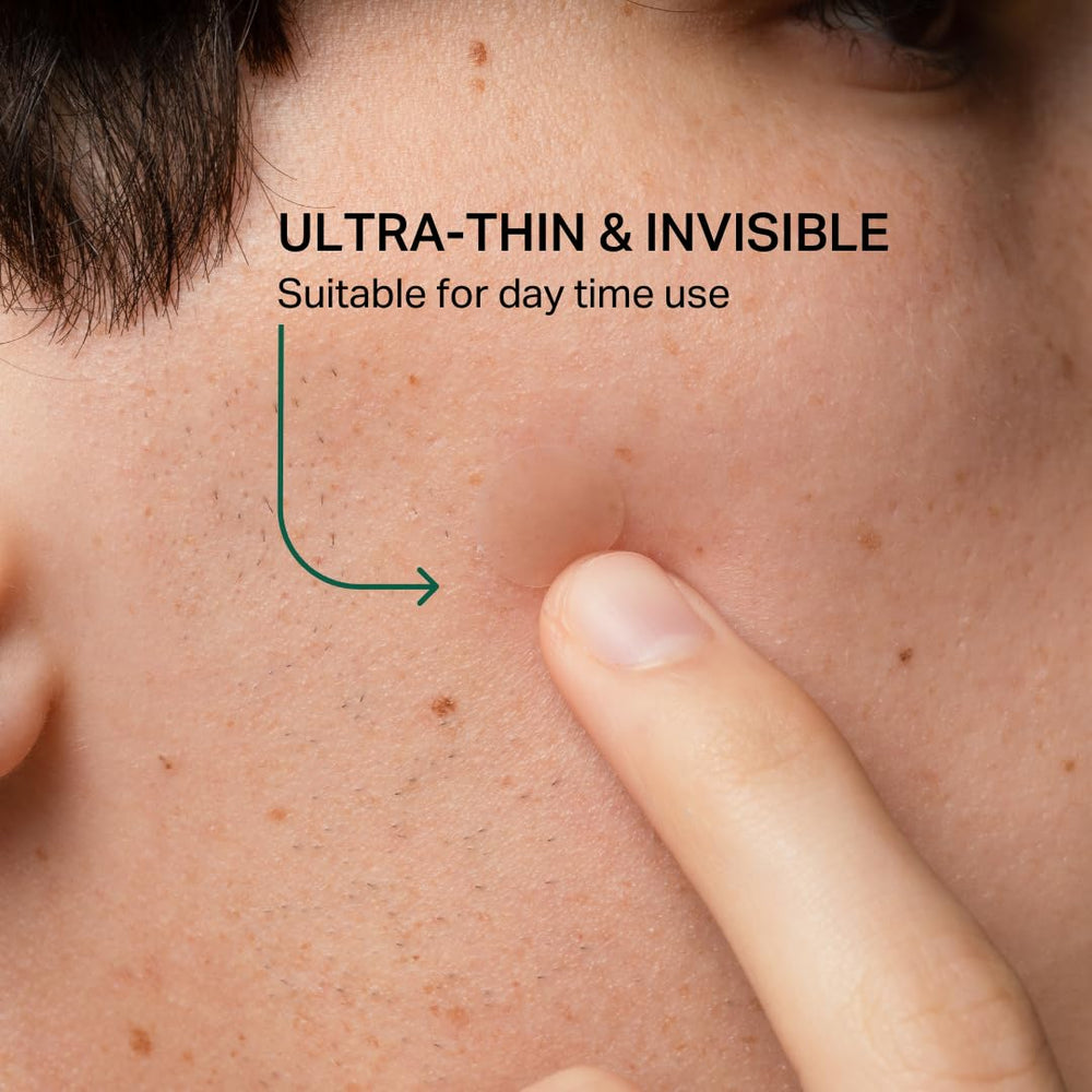 Y'OUR Improving Acne Patches placed on the skin to illustrate real-world use.