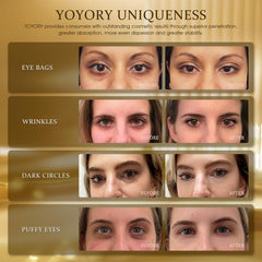 YOYORY cooling under-eye patch soothing tired eyes