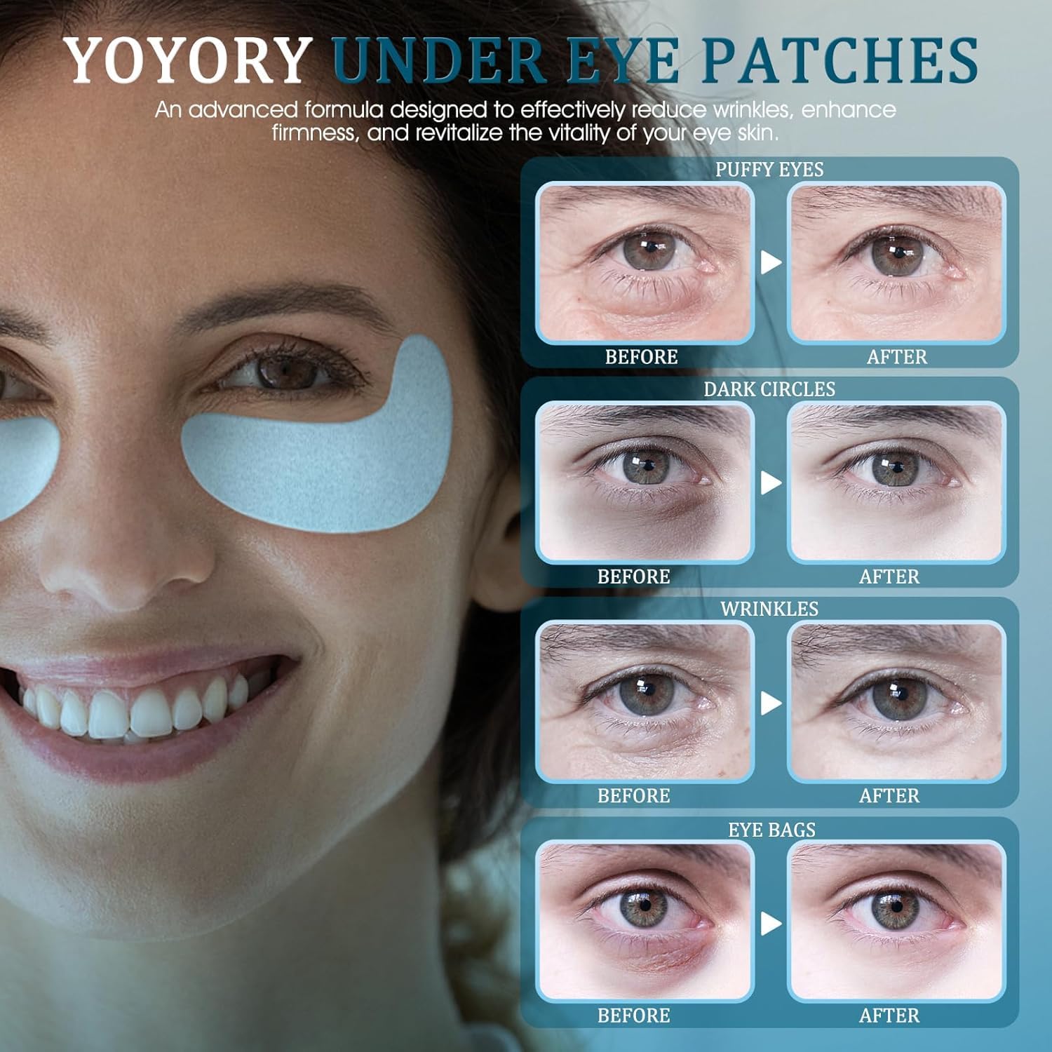 YOYORY under-eye patches pack opened for on-the-go use.