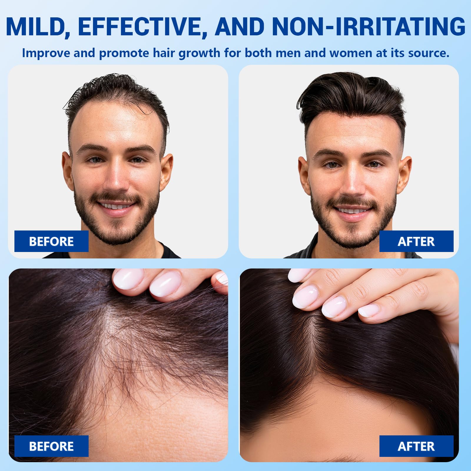 YUFUY blend of rosemary, castor, biotin niacinamide ingredients visual