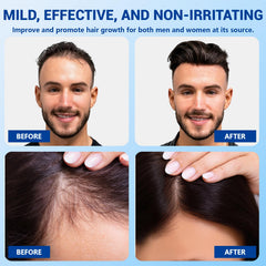YUFUY blend of rosemary, castor, biotin niacinamide ingredients visual