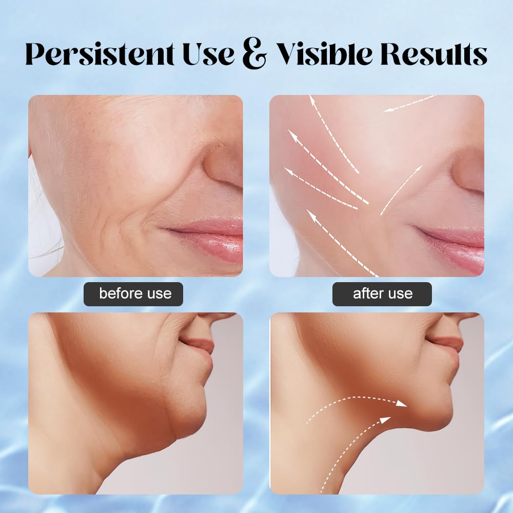YUNRUO neck and jawline session illustrating contouring potential
