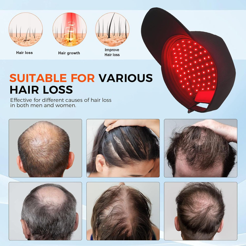 Yuxian Red Light Hair Growth Cap wireless design for flexibility