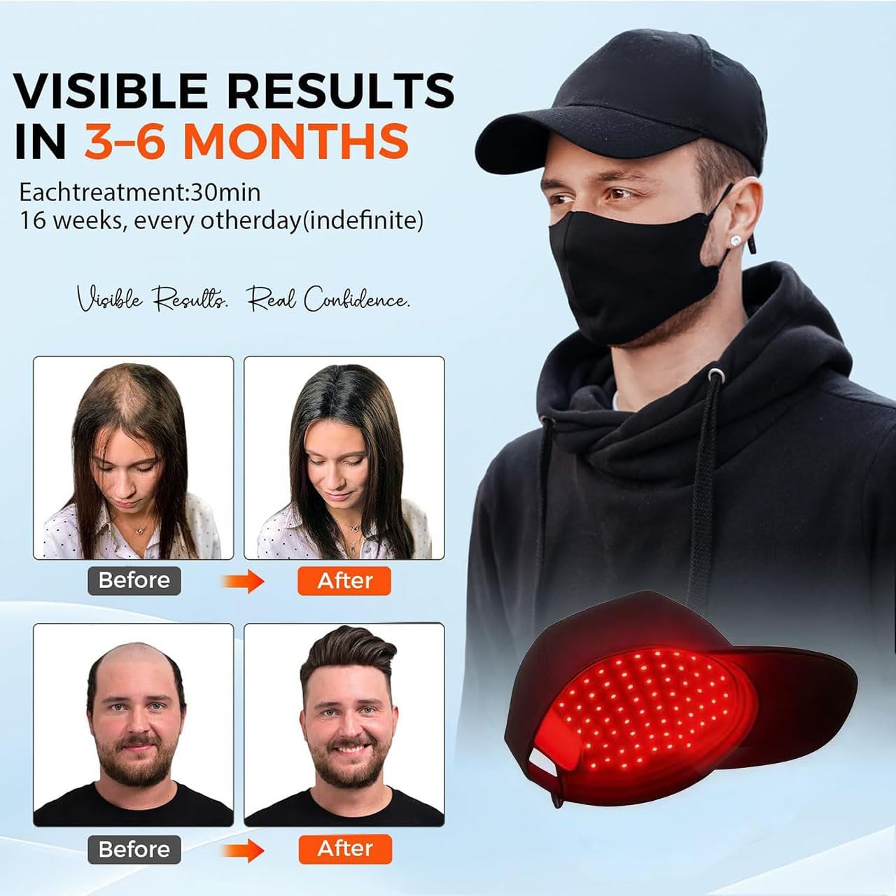 Yuxian Red Light Hair Growth Cap worn, snug fit supports mobility