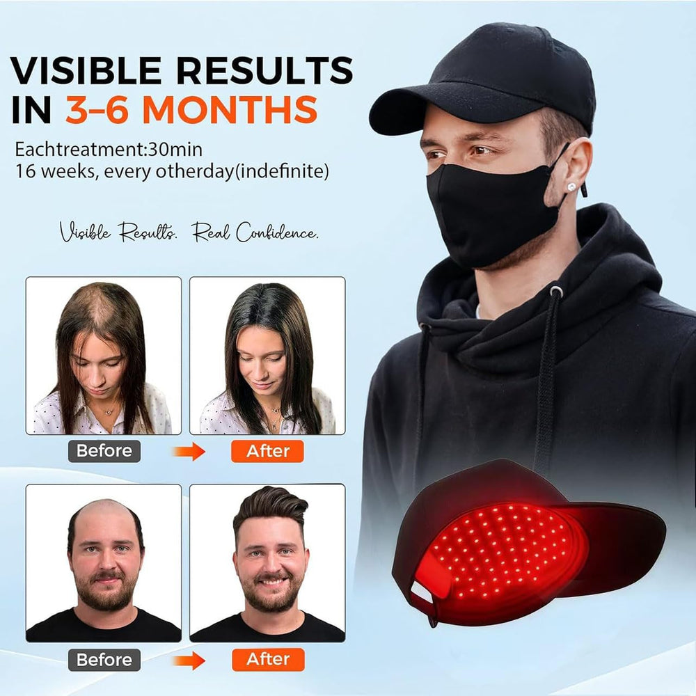 Yuxian Red Light Hair Growth Cap worn, snug fit supports mobility