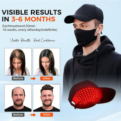 Yuxian Red Light Hair Growth Cap worn, snug fit supports mobility